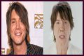 John Rzeznik Facelift | Goo Goo Dolls Frontman Plastic Surgery Before And After